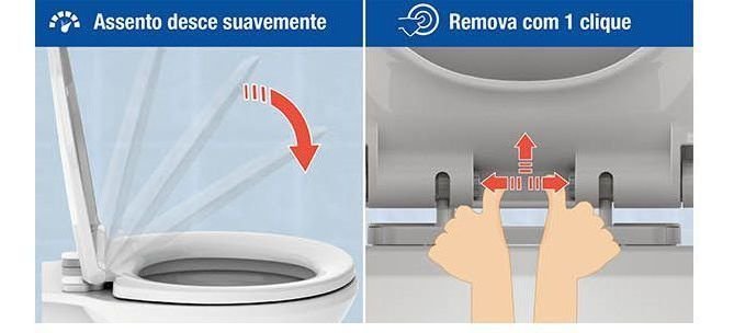 Assento Sanitario Com Sistema Soft Close E Limpeza Facil